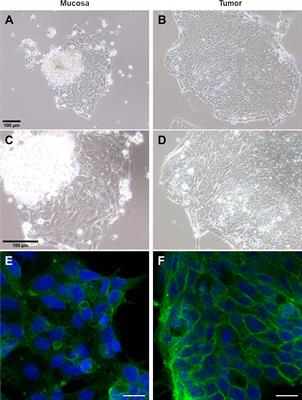 KRAS-specific antibody binds to KRAS protein inside colorectal adenocarcinoma cells and inhibits its localization to the plasma membrane